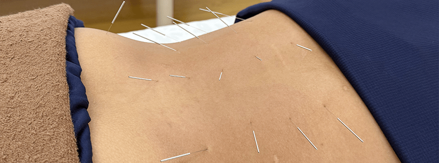 一人ひとりに合わせたオーダーメイド施術