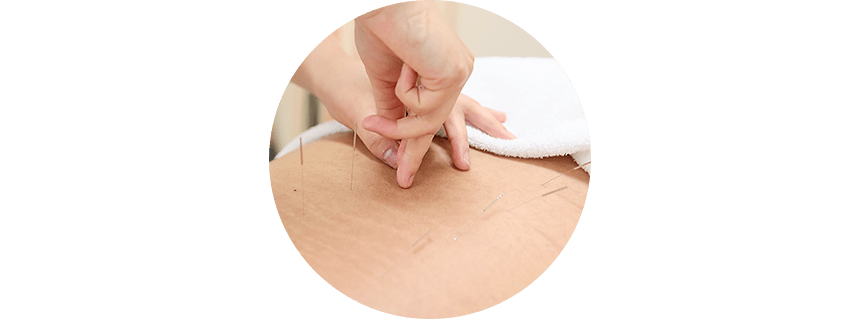 鍼は完全使い捨て