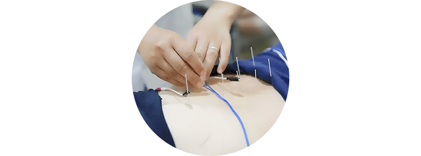 施術目的に最善を尽くす