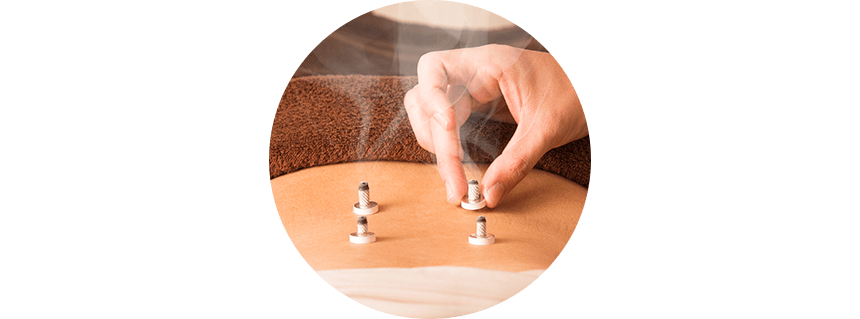 痕が残らないお灸